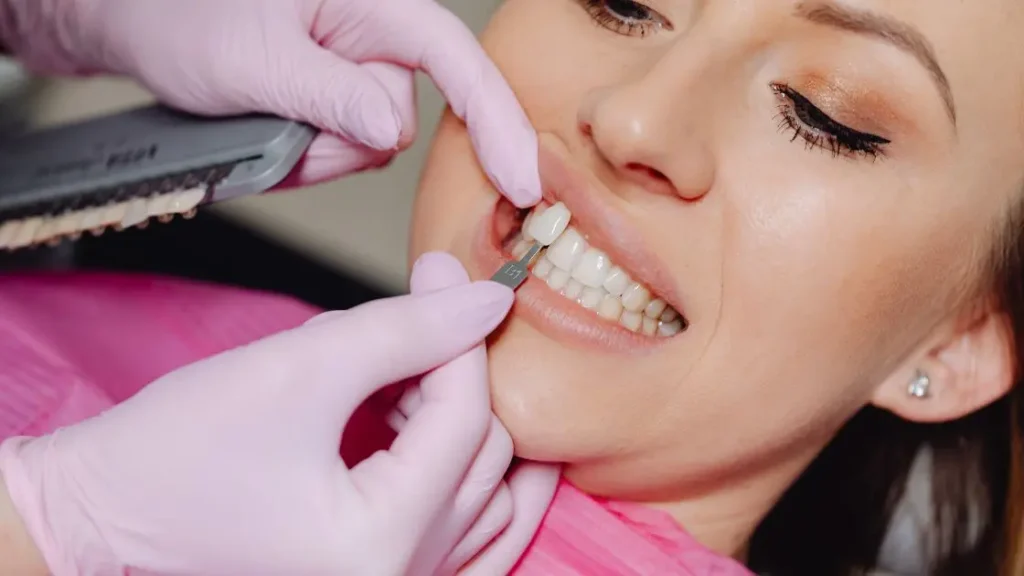 Dentista aplicando lentes de contato dental em um paciente com cuidado